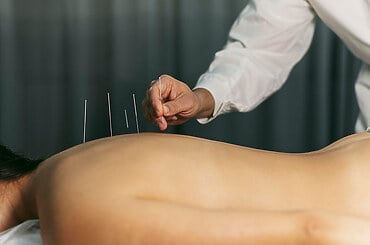 Top 05 Things to Avoid After Acupuncture